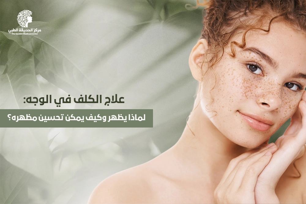 علاج الكلف في الوجه