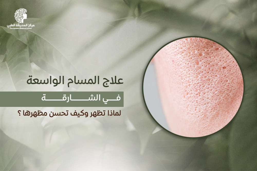 علاج المسام الواسعة في الشارقة