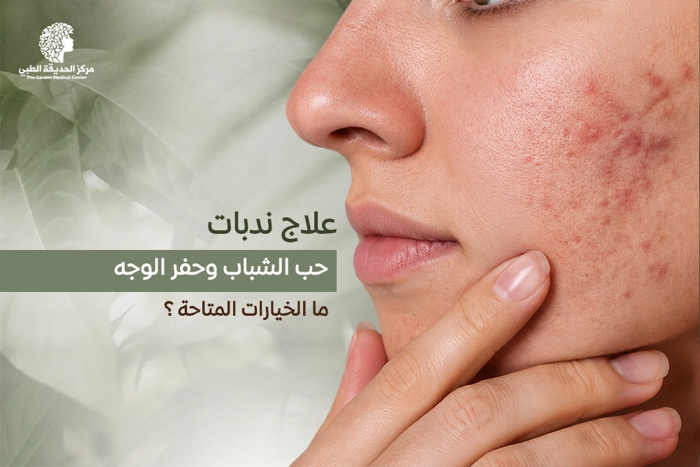 علاج ندبات حب الشباب