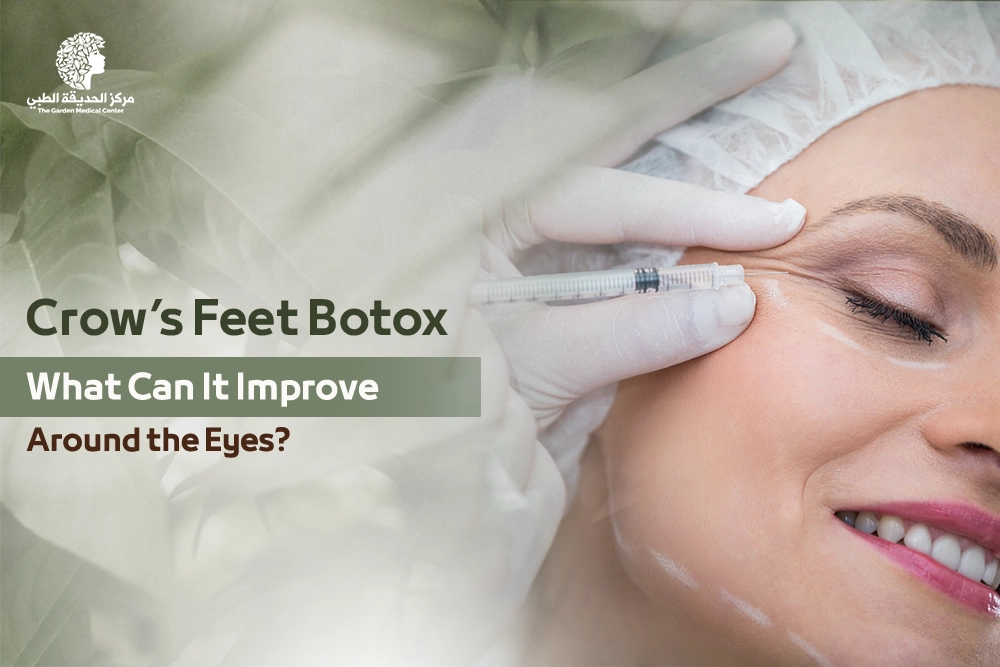 crow’s feet Botox in Sharjah