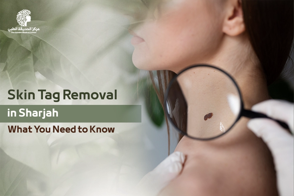 Skin tag removal in Sharjah